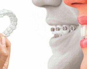 anfao4pjzikyprs1vfec