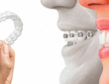 anfao4pjzikyprs1vfec